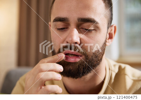 Close up view photo of young man applying cream on lip with irritation, cold rash. Treatments and colds. 121400475
