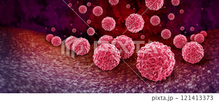 Chlamydia Infection Outbreak 121413373