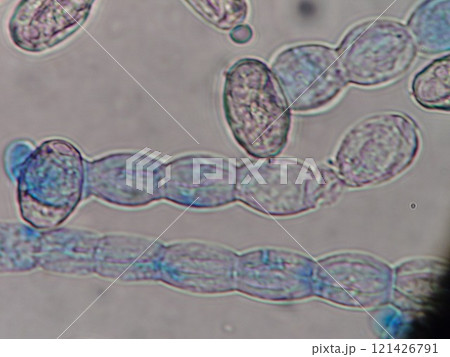 たくさん並んだうどん粉病の分生子 121426791