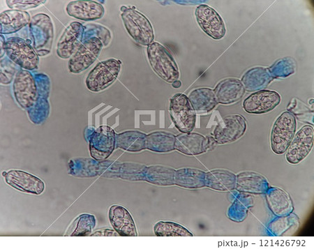 連鎖上に連なる分生子 121426792