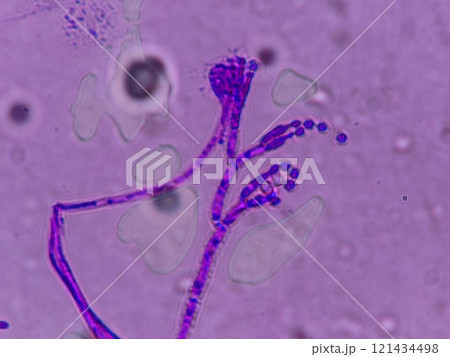 ペニシリウム属の分生子 121434498