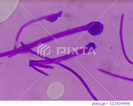 子嚢菌の分生子ができる過程 子嚢菌の分生子ができる過程 121434499