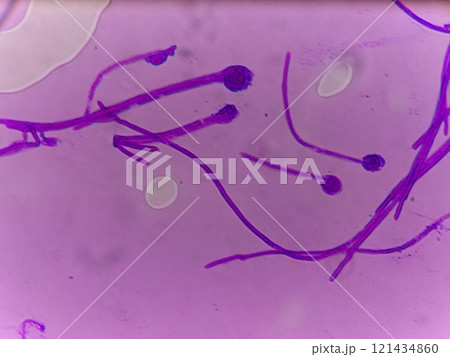 胞子嚢の形成過程 121434860