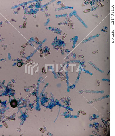 うどん粉病の胞子の顕微鏡写真 うどん粉病の胞子の顕微鏡写真 121435116