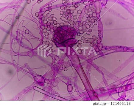 テンペ菌の胞子が破裂した様子 121435118