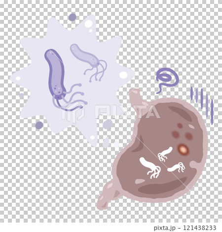 Illustration of a stomach infected with Helicobacter pylori 121438233