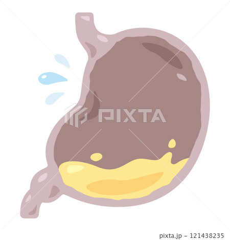 胃酸不足状態の胃のイラスト 121438235
