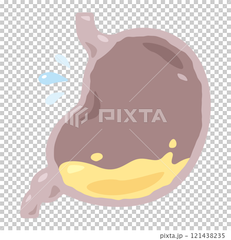 胃酸不足状態の胃のイラスト 121438235