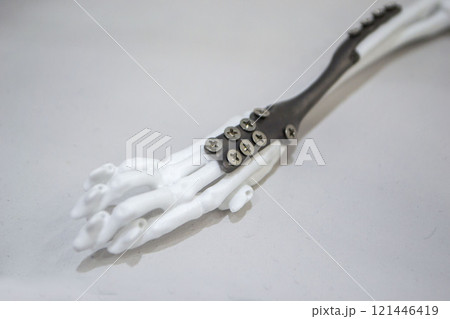 Implants and prostheses printed on 3D printer from biocompatible titanium powder. Plates for correction of deformation for animals. Titanium plates on animal bones printed on 3D printer from plastic. Implants and prostheses printed on 3D printer from biocompatible titanium powder. Plates for correction of deformation for animals. Titanium plates on animal bones printed on 3D printer from plastic. 121446419