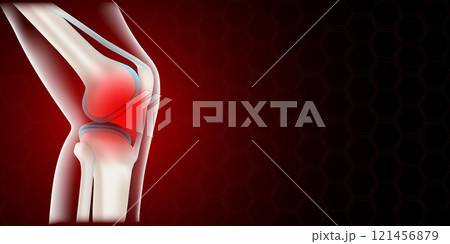 Knee inflammation. joint pain. banner 121456879