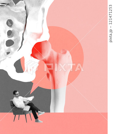 Poster. Contemporary art collage. Professional sits examining hip bone with red inflammation and on top of it transparent speech bubble, as recommendation. 121471253