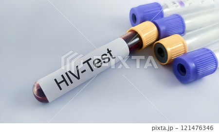 Sample blood for screening test for HIV test 121476346