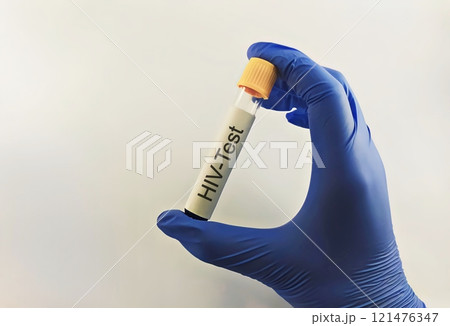 Sample blood for screening test for HIV test 121476347