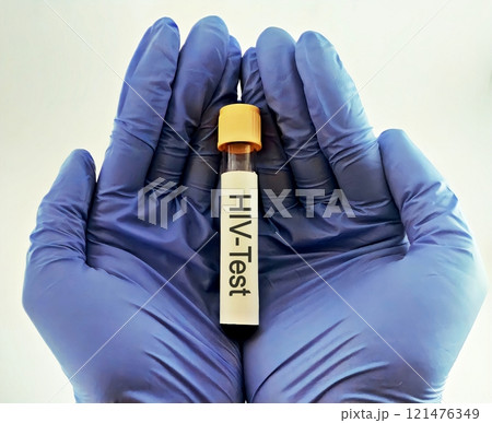 Sample blood for screening test for HIV test 121476349
