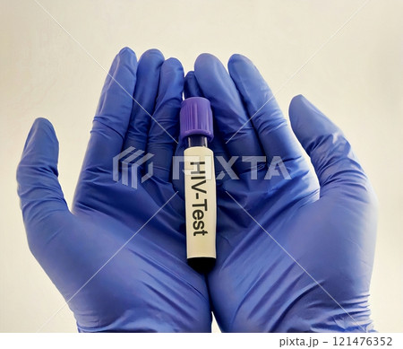 Sample blood collection tube with HIV test label on HIV infection screening test form. 121476352