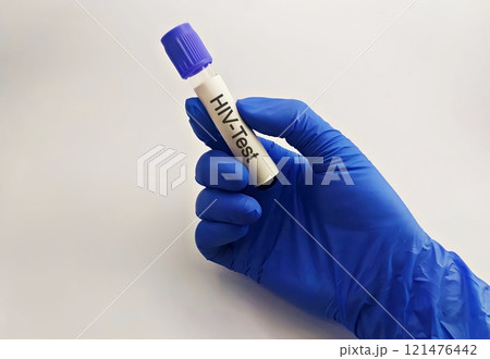Sample blood collection tube with HIV test label on HIV infection screening test form. Sample blood collection tube with HIV test label on HIV infection screening test form. 121476442