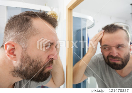 Worried man looking at his decreasing hairline Worried man looking at his decreasing hairline 121478827