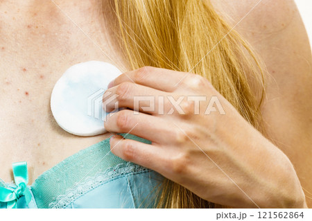 Woman acne on neckline cleaning skin with tonic Woman acne on neckline cleaning skin with tonic 121562864
