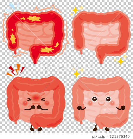動きが過剰になっている腸のキャラクターと元気な腸のキャラクター 121576349
