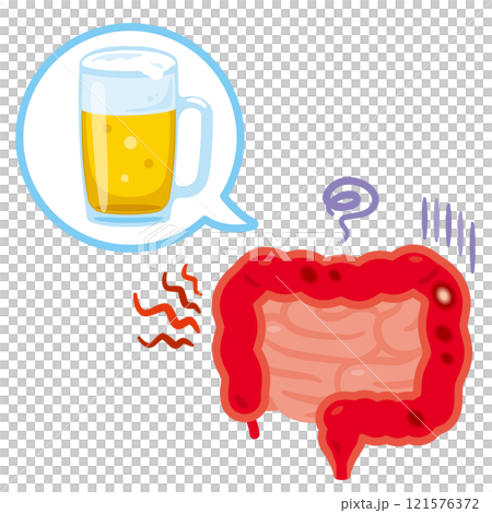 Illustration of intestines inflamed by alcohol 121576372