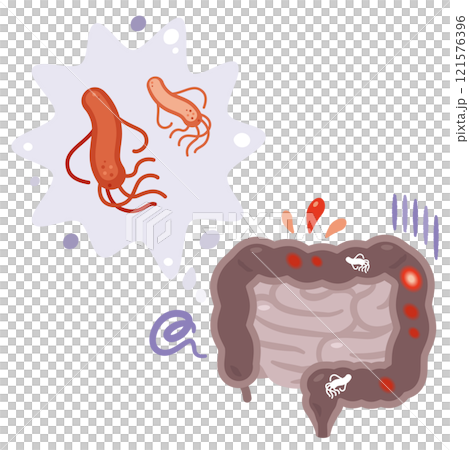 大腸菌に感染した腸のイラスト 121576396