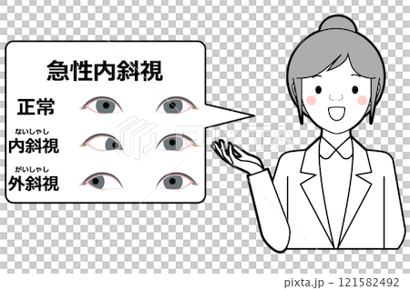 急性内斜視 急性内斜視 121582492