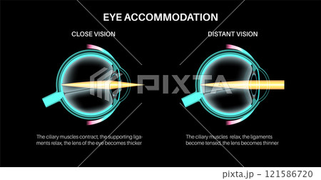 Eye accommodation poster 121586720