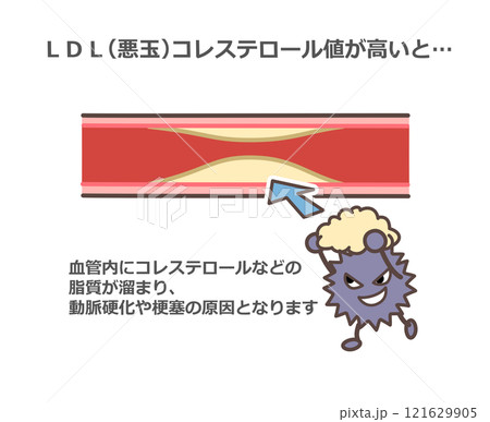 悪玉コレステロールと血管 121629905