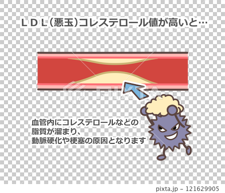 悪玉コレステロールと血管 121629905