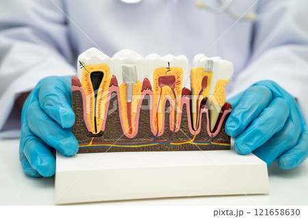 Dentist holding dental implant, artificial tooth roots into jaw, root canal of dental treatment, gum disease, teeth model for dentist. Dentist holding dental implant, artificial tooth roots into jaw, root canal of dental treatment, gum disease, teeth model for dentist. 121658630