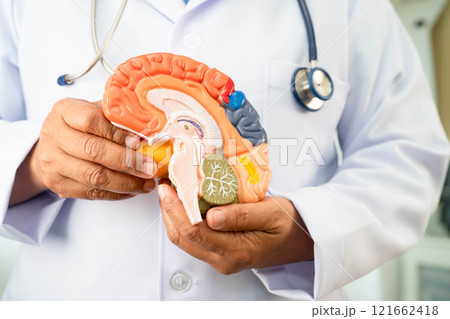 Alzheimer disease, Asian doctor holding brain anatomy model for study diagnosis and treatment in hospital. 121662418