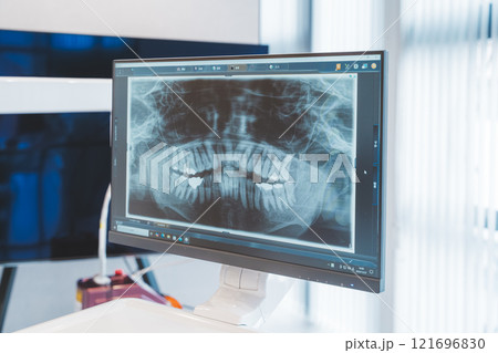 歯のレントゲン写真 121696830