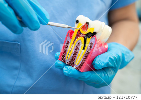 Teeth root dental model with tool for dentist use to cleaning care treatment. 121710777