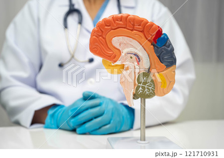 Alzheimer disease, Asian doctor holding brain anatomy model for study diagnosis and treatment in hospital. 121710931