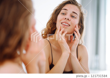 Beautiful woman touches her inflammation on her face while looking in the mirror in a bright room. 121731584