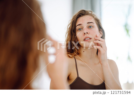 Beautiful woman touches her inflammation on her face while looking in the mirror in a bright room. 121731594