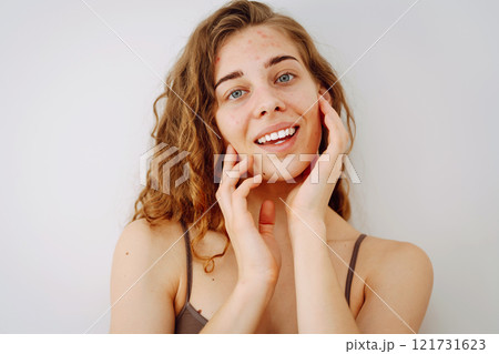 Close-up of a cute woman with problem skin looking in the mirror. Dermatology concept, allergy. Close-up of a cute woman with problem skin looking in the mirror. Dermatology concept, allergy. 121731623