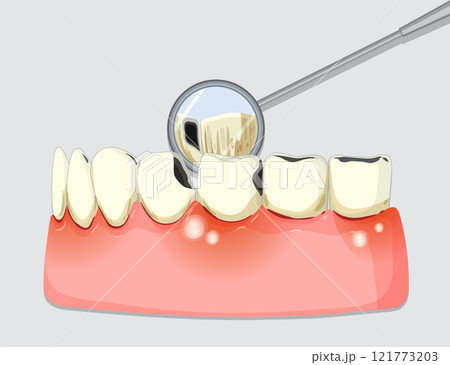 Dental Checkup with Mirror Tool 121773203