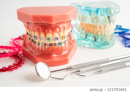 Orthodontic ligatures rings and ties, elastic rubber bands on orthodontic braces, model for dentist studying about dentistry. Orthodontic ligatures rings and ties, elastic rubber bands on orthodontic braces, model for dentist studying about dentistry. 121791681
