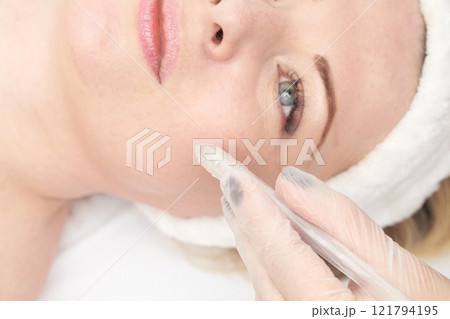 Caucasian female receiving facial treatment with dermal roller in spa setting 121794195