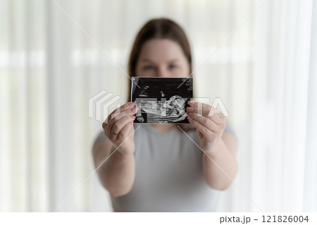 Gen Z pregnant woman holding showing ultrasound scan photo of a fetus. Concept of pregnancy, Maternity prenatal care 121826004