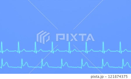 ECG comparison of the normal heart rhythm of a healthy patient and the ECG of a patient with myocardial infarction. 121874375