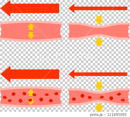 Deformed illustration of blood vessel expansion and contraction 121895085