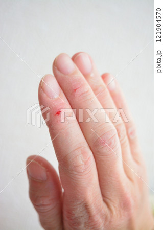 女性の乾燥した手 121904570