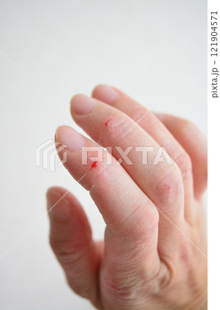 女性の乾燥した手 女性の乾燥した手 121904571