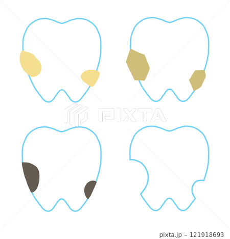 虫歯になっていく過程のセット 121918693
