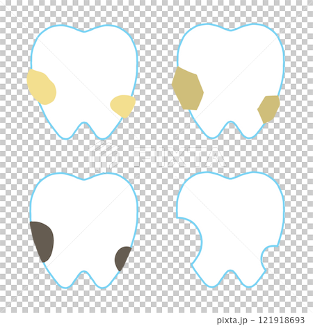 虫歯になっていく過程のセット 121918693