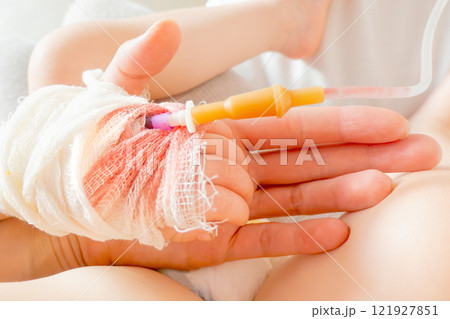 baby in hospital with intravenous saline. Sick children, are lying and being treated in beds in hospitals. baby in hospital with intravenous saline. Sick children, are lying and being treated in beds in hospitals. 121927851