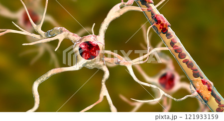 Astrocyte and blood vessel Astrocyte and blood vessel 121933159