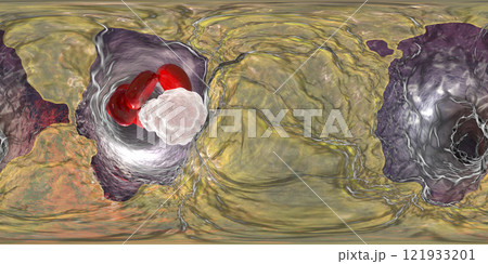 Atherosclerosis, atheromatous plaque inside artery 121933201